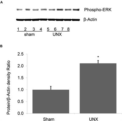 Unilateral Nephrectomy Stimulates ERK and Is Associated With Enhanced Na Transport